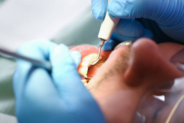 Best Cracked Tooth Emergency Dentist  in Lithia Springs, GA