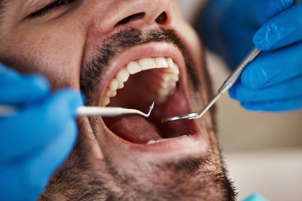 Best Broken Tooth Emergency  in Lithia Springs, GA